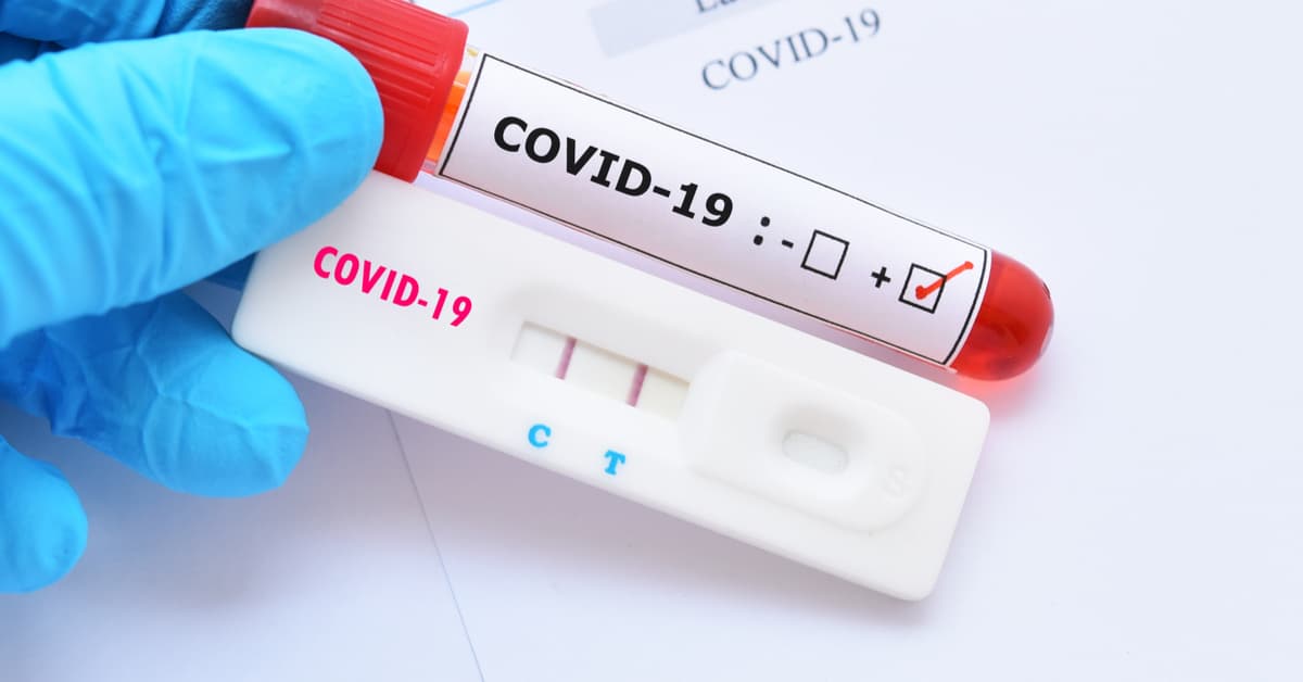 Realize o teste coronavírus (COVID-19).